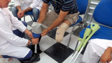 مويدي: الديوان تكفل بأكثر من 100 ألف شخص من ذوي الإحتياجات الخاصة خلال 2025
