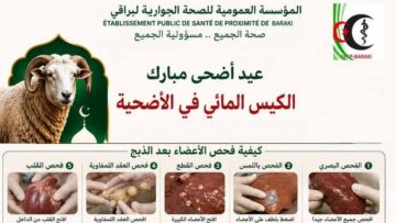 ايام تحسيسية حول خطر مرض الكيس المائي ببراقي